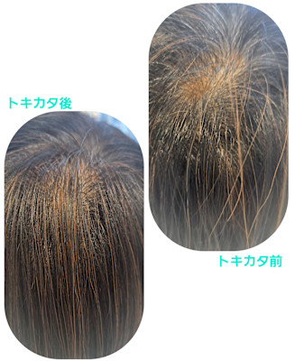 話題のトキカタ♪頭頂部編