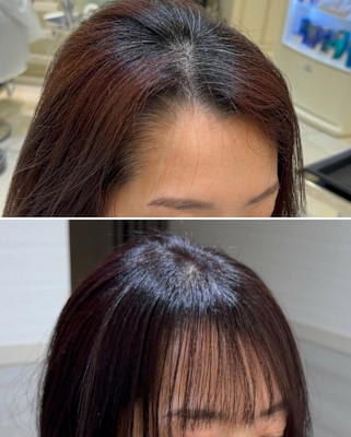 生え癖解消クロスパーマ