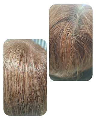 話題のトキカタ♪頭頂部編