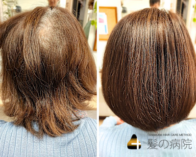 【K&K広田】× 髪質改善カラー