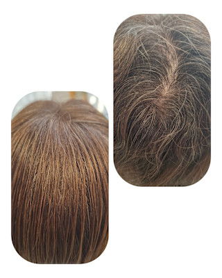 話題のトキカタ♪頭頂部編