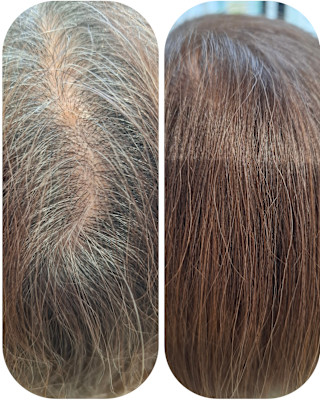 話題のトキカタ♪頭頂部編