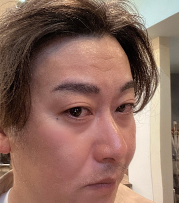 マイクロブレーディング