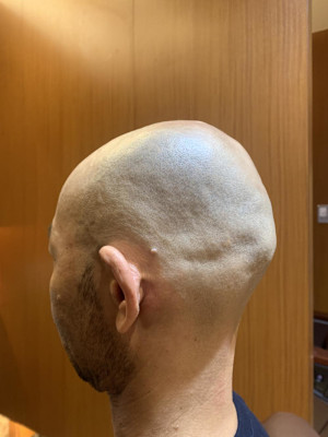 銀座　スキンヘッド