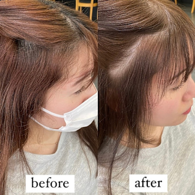 前髪縮毛矯正