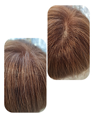 話題のトキカタ♪頭頂部編