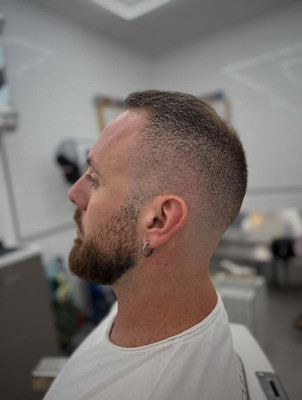 スキンフェード