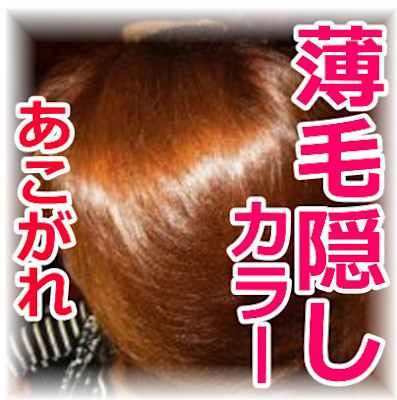 キングスクロス（キングスクロス）