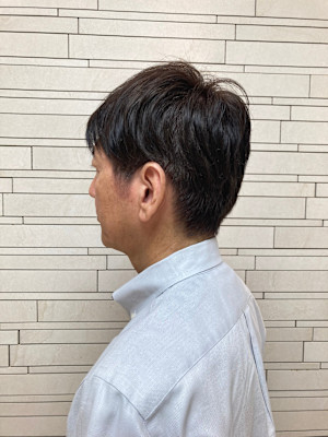 60代男性《アフター→ビフォー》