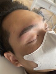 HBL / ハリウッドブロウリフト