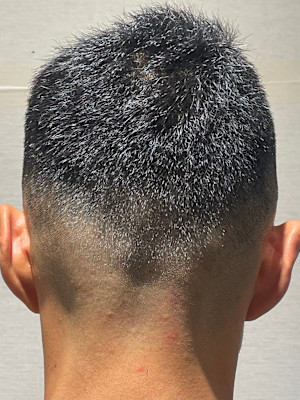 スキンフェードスタイル