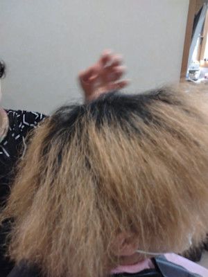 酸性縮毛矯正ビフォー癖が強くブリーチ毛　切れ毛がだいぶ有り。