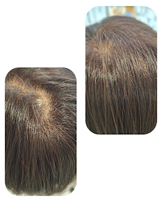 話題のトキカタ♪頭頂部編