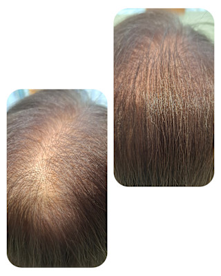 話題のトキカタ♪頭頂部編