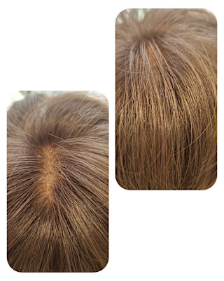 話題のトキカタ♪頭頂部編