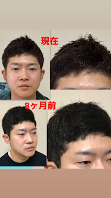 ツーブロックレイヤー