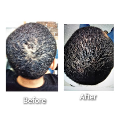 Beauty Science BOOZ×スタイル