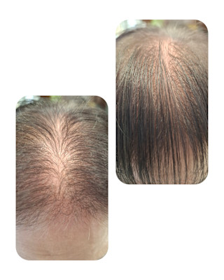 話題のトキカタ♪前髪編