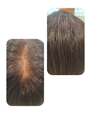 話題のトキカタ♪頭頂部編