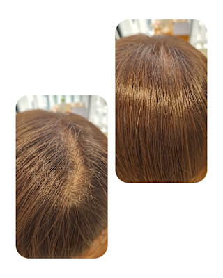 話題のトキカタ♪頭頂部編