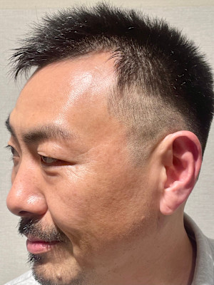 スキンフェード