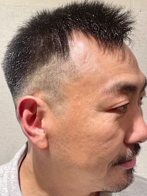 スキンフェード