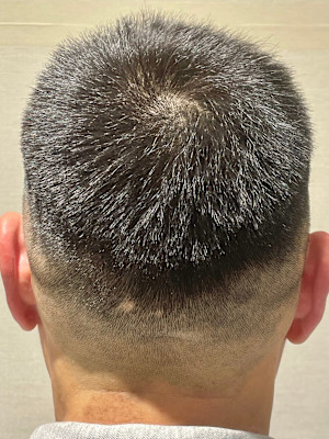 スキンフェード