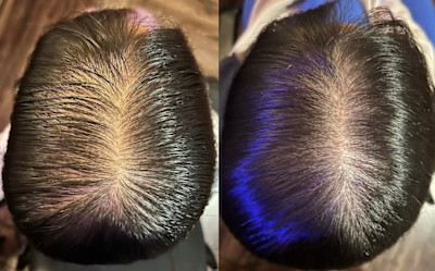 解頭リリース【スペシャル】（シャンプー・ブロー付）