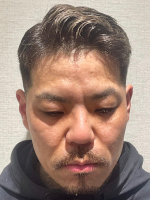 ミドルフェード