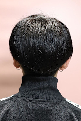 シースルーマッシュ