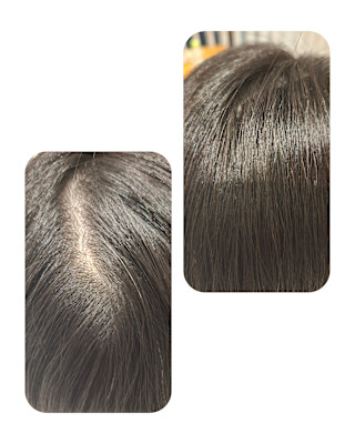 話題のトキカタ♪頭頂部編