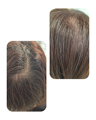 話題のトキカタ♪頭頂部編