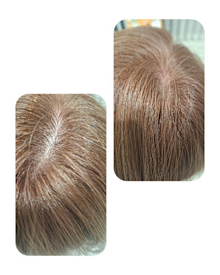 話題のトキカタ♪頭頂部編