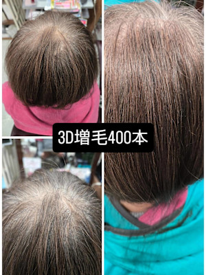 {毛量アップ】つむじ隠し３D増毛エクステ