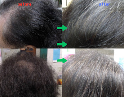 解頭リリース《ベーシック》（シャンプー・ブロー付）