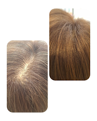 話題のトキカタ♪頭頂部編