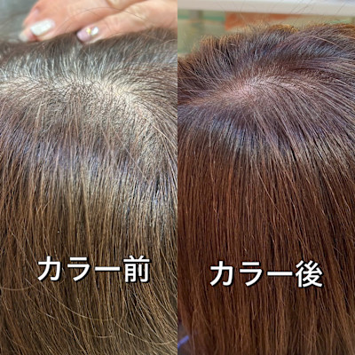 お白髪染め　ビフォーアフター