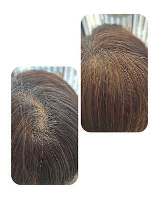 話題のトキカタ♪頭頂部編