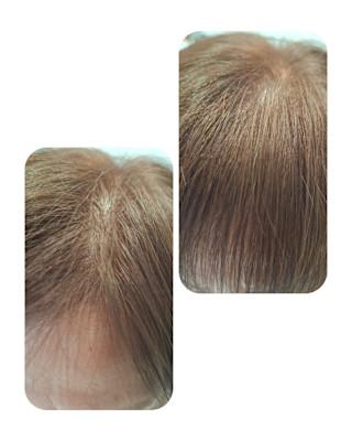 話題のトキカタ♪前髪編