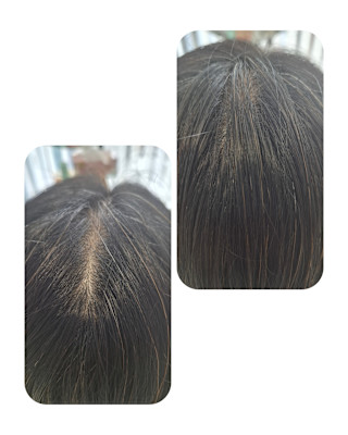 話題のトキカタ♪頭頂部編