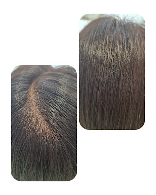 話題のトキカタ♪頭頂部編