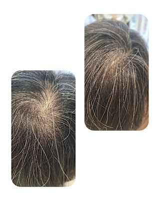 話題のトキカタ♪頭頂部編