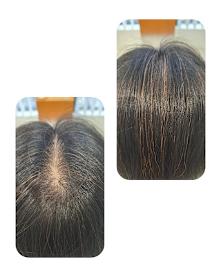 話題のトキカタ♪頭頂部編