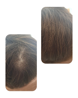 話題のトキカタ♪頭頂部編