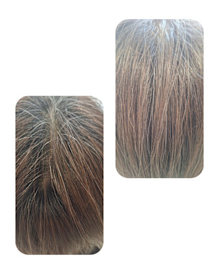 話題のトキカタ♪頭頂部編