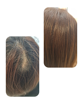 話題のトキカタ♪頭頂部編