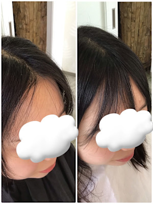 シースルーバング