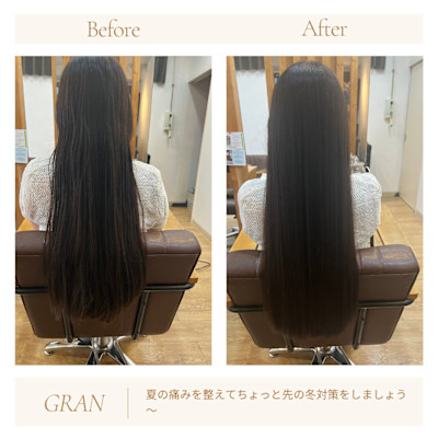 夏におったダメージ気になりませんか？　2097 