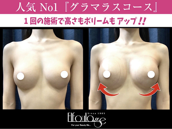 【バスト＆ヒップ専門店】エルフラージュ銀座店(バストアンドヒップセンモンテンエルフラージュギンザテン)
