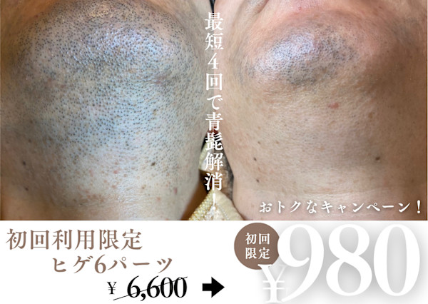 メンズ脱毛FiGO天満店(メンズダツモウフィーゴテンマテン)